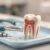 Endodoncja: jak ratować zęby przed ekstrakcją? Kluczowe informacje