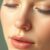 Bruzdy nosowo-wargowe: przyczyny, metody spłycania i jak uniknąć najczęstszych mitów